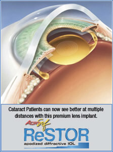 Dr. Fishman, Cataract Surgery Pembroke Pines